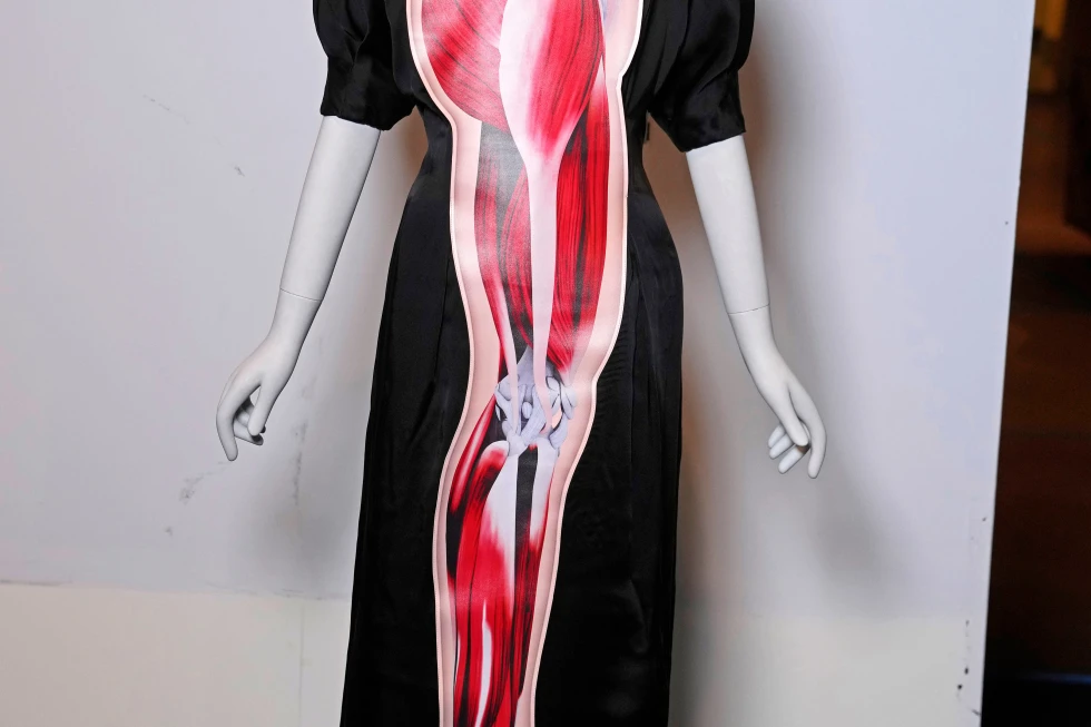 A Christopher Kane dress is displayed in preparation for The Metropolitan Museum of Art’s spring exhibition, “Costume Art,” on Thursday, Feb. 12, 2026, in New York. (Photo by Charles Sykes/Invision/AP)